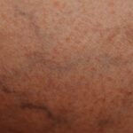Haut-Nahaufnahme, natürliche Textur