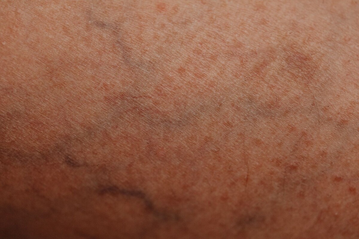 Haut-Nahaufnahme, natürliche Textur